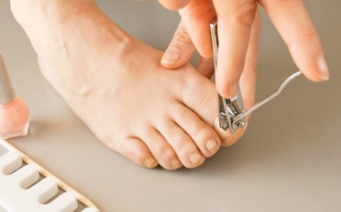 Is It Painful To Have Your Toenail Removed