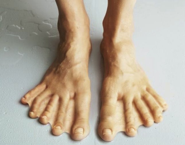 webbed feet human